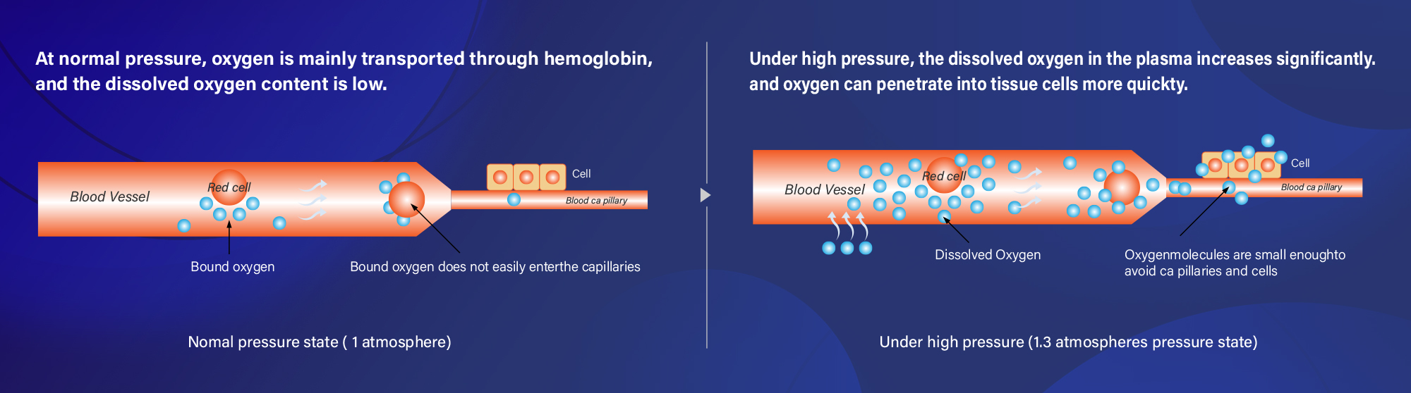 Mild hyperbaric oxygen chamber illustration